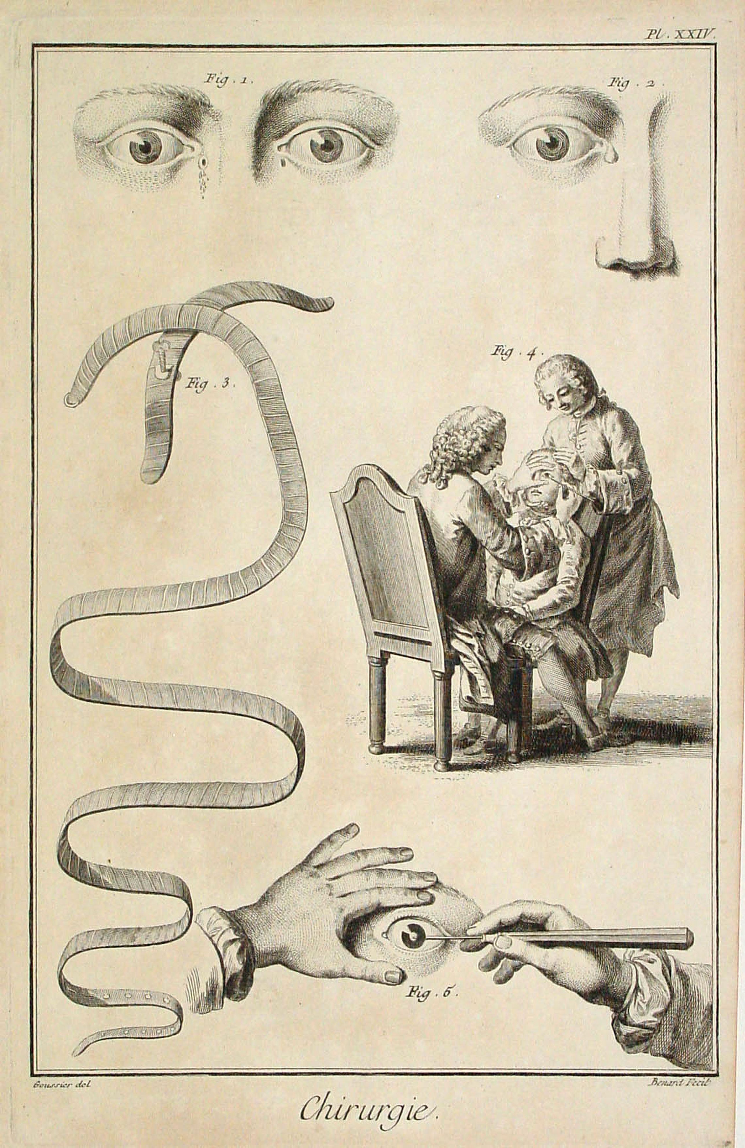 DIDEROT,D., Chirurgie, plate XXIV, antique map, old maps