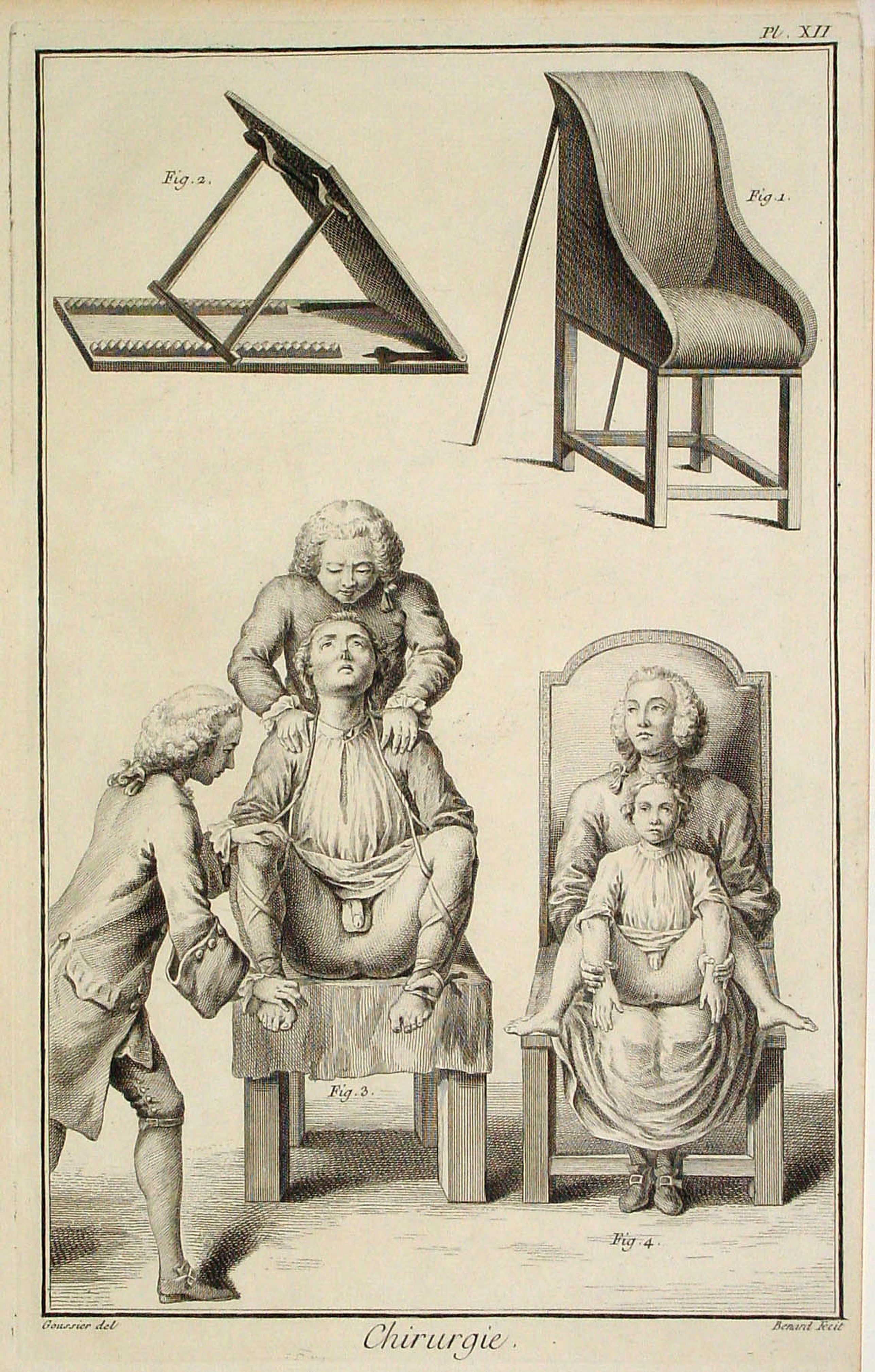 DIDEROT,D., Chirurgie, plate XII, antique map, old maps