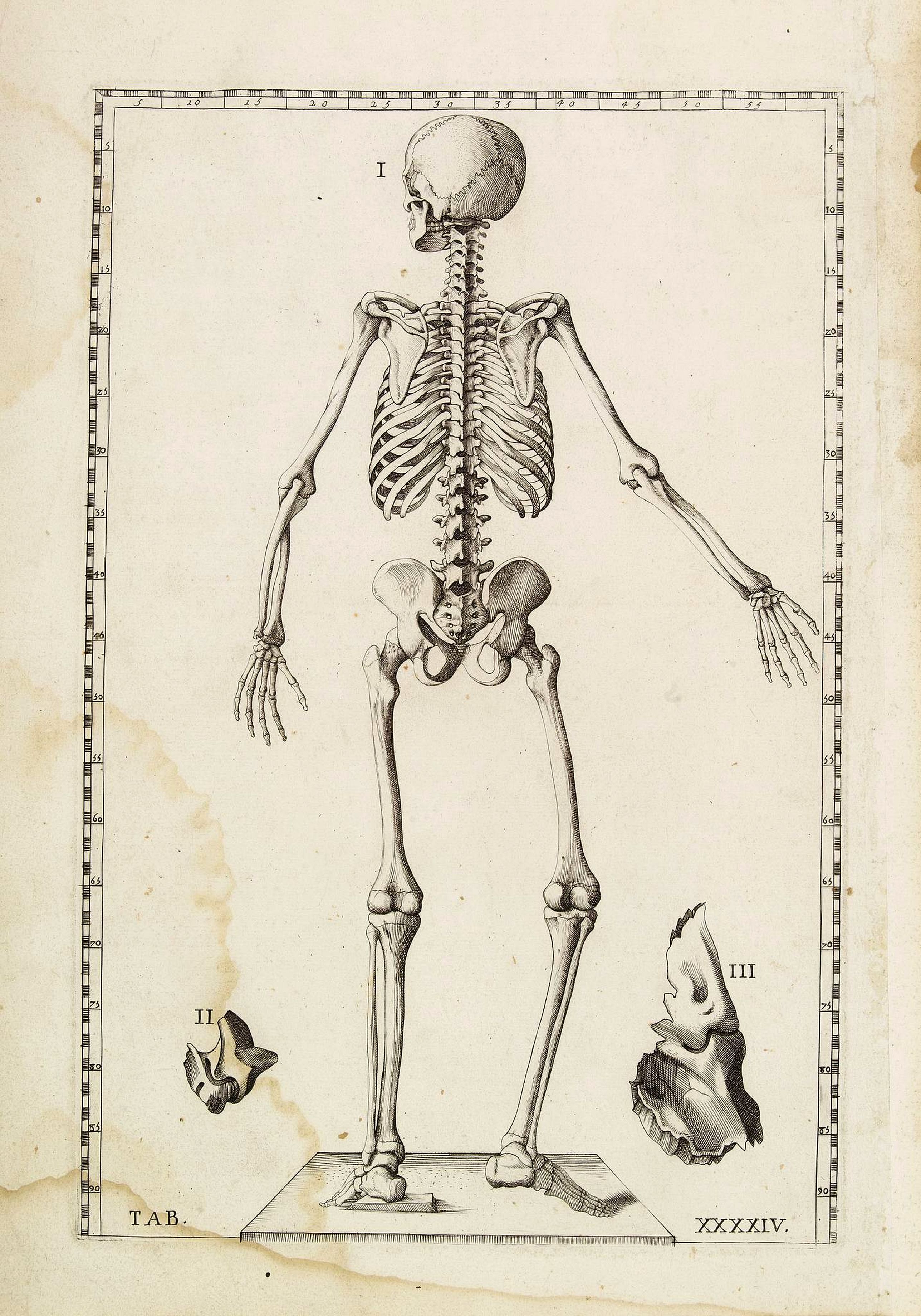LANCISI,G.M., Anatomical print. TAB. XXXXIV., antique map, old maps
