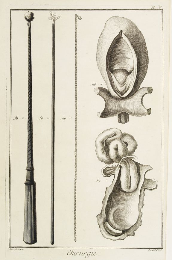 DIDEROT,D., Chirurgie, plate V., antique map, old maps