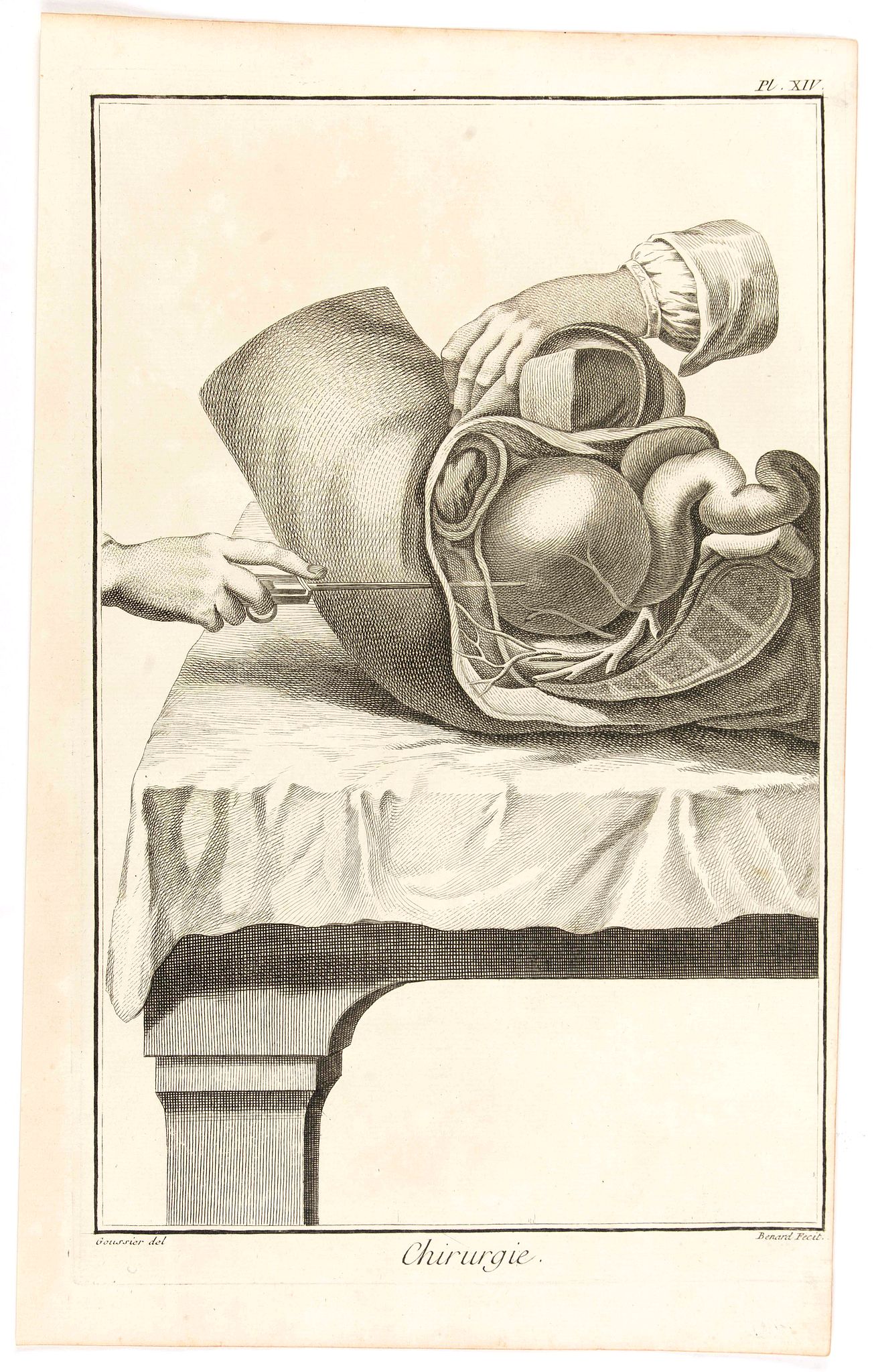 DIDEROT, D., Chirurgie, plate XIV., antique map, old maps
