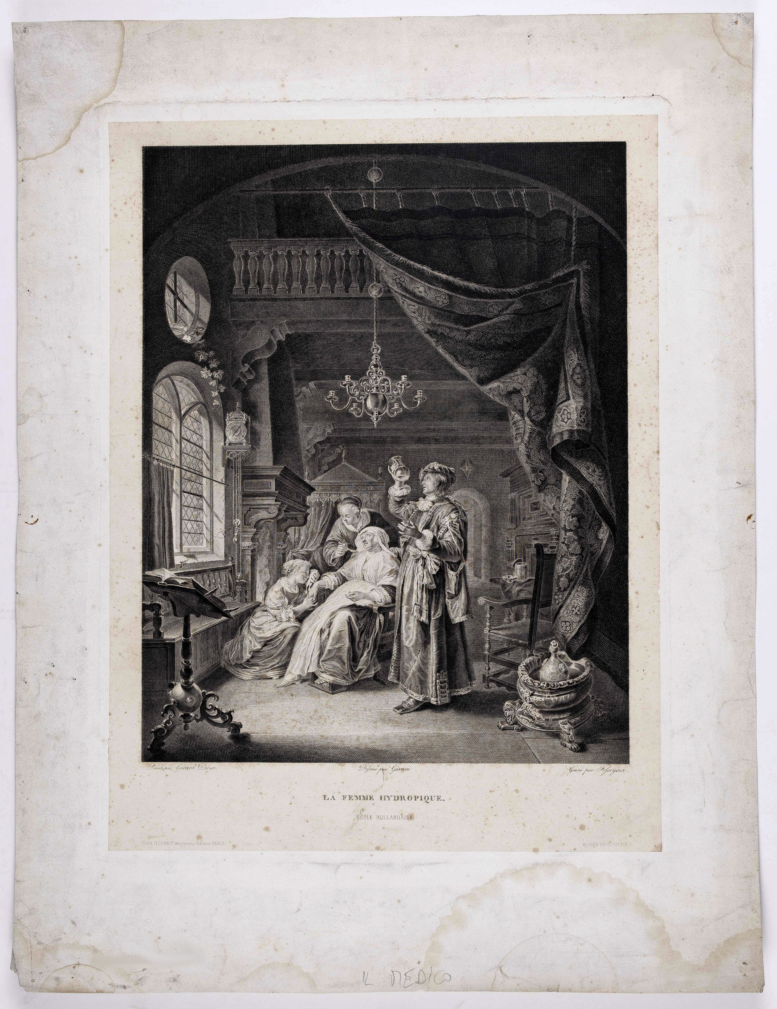 DOUW, G. (after), La femme hydropique. Ecole Hollandaise., antique map, old maps