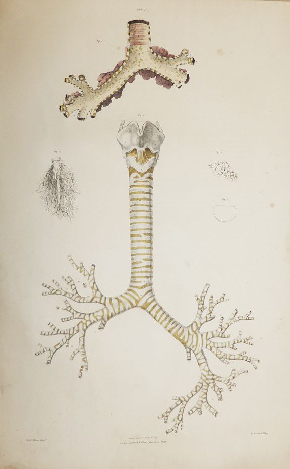 The Anatomy of the Trachea and Bronchial Tubes. Old map by Taylor and