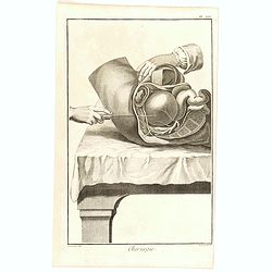 Chirurgie, plate XIV.